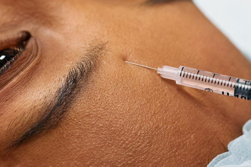 Botoxbehandling: Forståelse, Fordele og Overvejelser